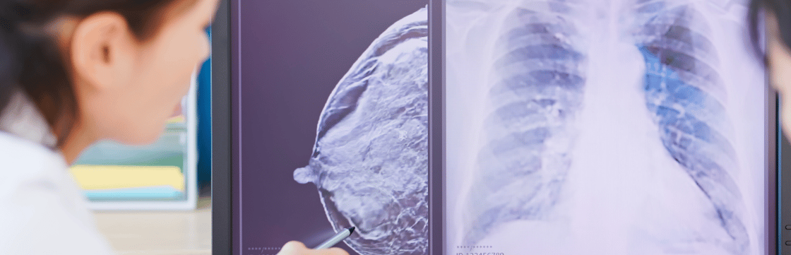 Image shows clinician looking at a mammogram 