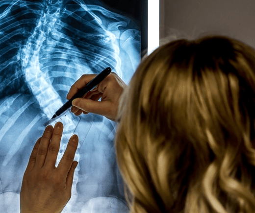 A doctor looks at a curved spine on an x-ray